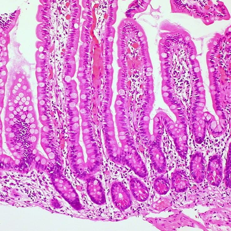 Coupe histologique d’une muqueuse d’intestin grêle observée au microscope : les villosités, longues franges alignées, sont colorées en rose et violet